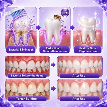 MiniMind™ Bee Venom Gum & Periodontal Toothpaste