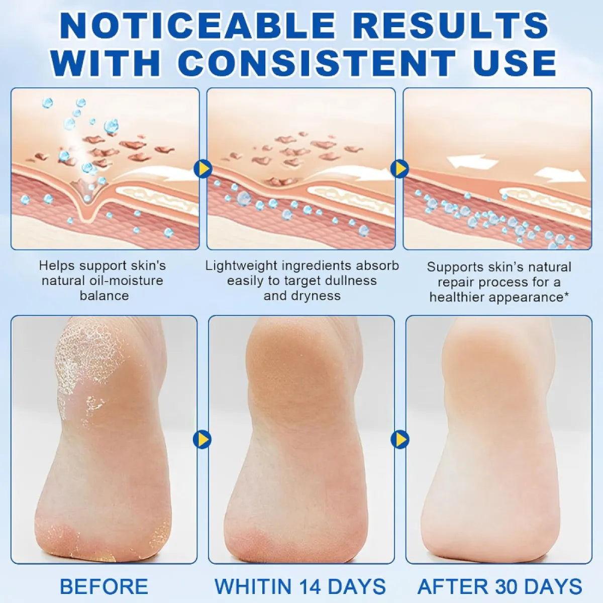 MiniMind® 60% Urea Foot Relief Stick