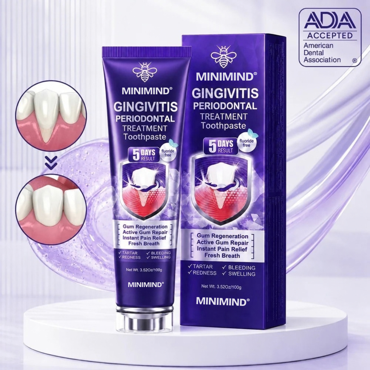 MiniMind™ Bee Venom Gum & Periodontal Toothpaste