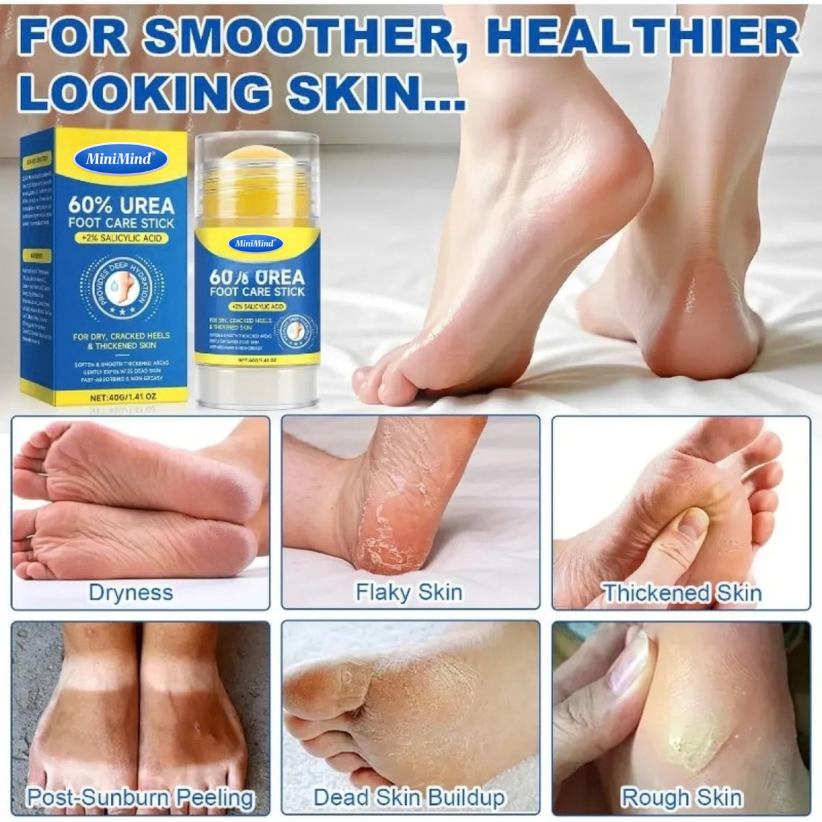 MiniMind® 60% Urea Foot Relief Stick